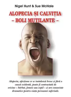 Alopecia si calvitia - Paperback brosat - Nigel Hunt, Sue McHale - Antet Revolution