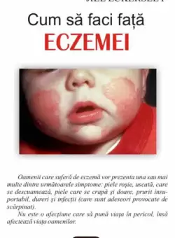 Cum sa faci fata eczemei - Paperback brosat - Jill Eckersley - Antet Revolution